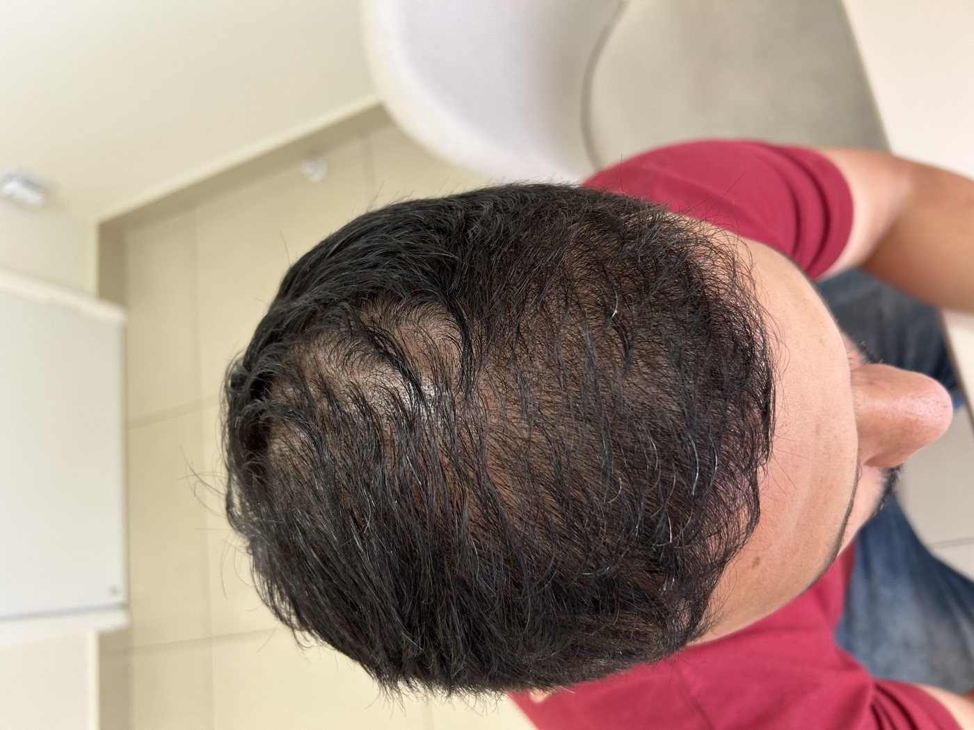 Antes