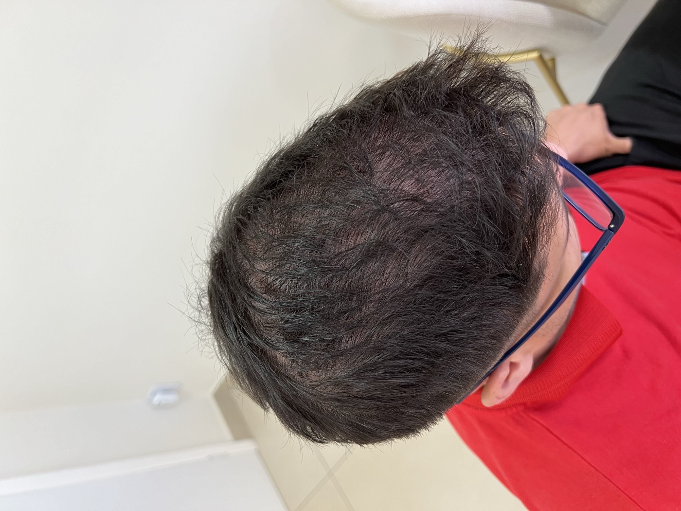 Antes